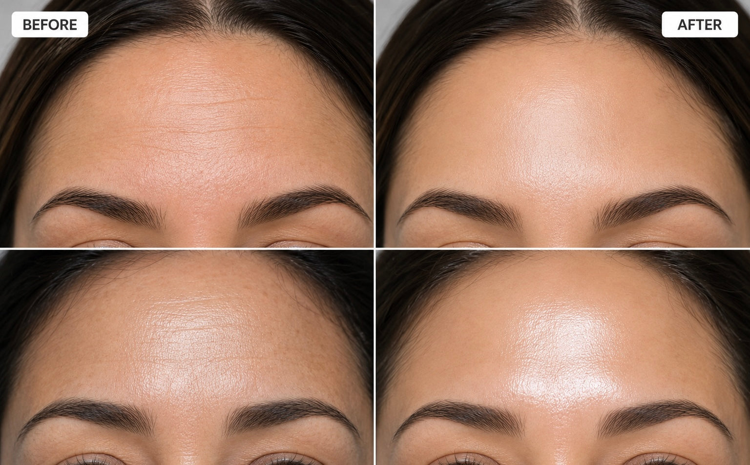 Resultados de piel antes y después de retinol y colágeno